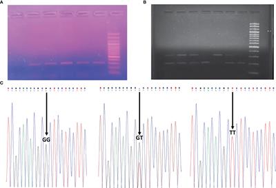 In silico analysis of single nucleotide polymorphism (rs34377097) of TBXA2R gene and pollen induced bronchial asthma susceptibility in West Bengal population, India